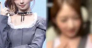 [K-Pop Shock] IVE's Rei Reveals Starship Asked Her to Remove Neck Mole: 'A Treasure From My Mom'